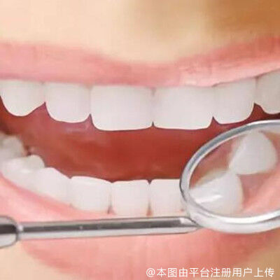 如何正确的预防牙髓炎呢