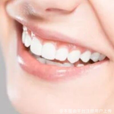 老是用牙齿开瓶盖，殊不知你的牙齿被伤害得很厉害！