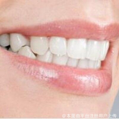 刷牙刷了这么久居然没一点用？！原来都是错误刷牙吗？
