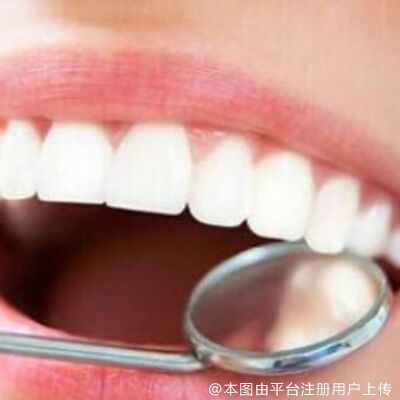 听说牙齿美观也有秘密--明星们也都偷偷在做的牙贴面！