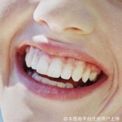 网友：牙烂了我是选择种植牙还是烤瓷牙呢？