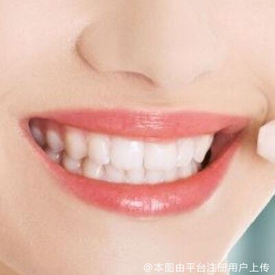 洗牙价格这么亲民，怎么很多人都不愿意洗呢？原来是陷入误区了！
