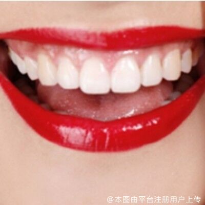 口腔溃疡这么“磨”人，做什么才能把它赶走呢？