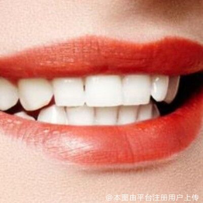 网友：做了烤瓷牙还想再做牙齿矫正，这算瞎折腾吗？