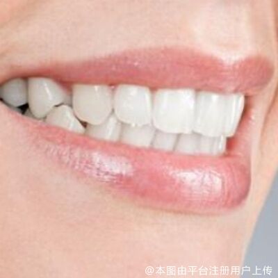 网友：为啥总是莫名其妙牙齿酸痛？有什么办法缓解吗？