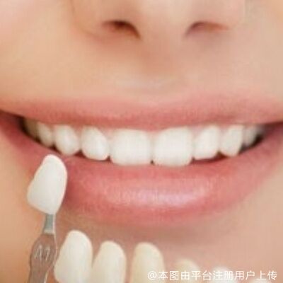 听说全瓷牙“寿命”很短？到底值不值得选择呢？