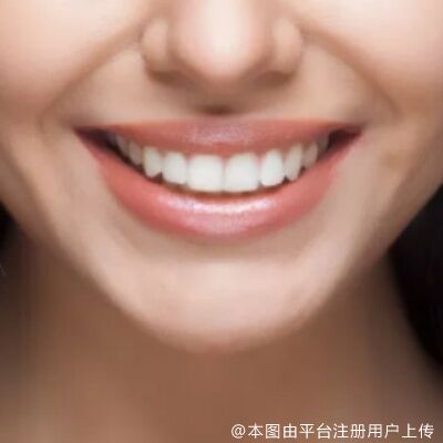 都说越早整牙越好，牙齿矫正解决的问题可多了去了！