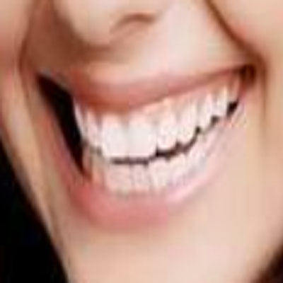 修补牙齿并不意味着一劳永逸，你了解牙齿修复的奥秘吗？