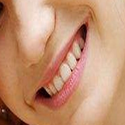 别傻了，这些肆意的智齿需要尽快拔掉