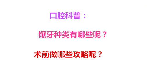 口腔科普：镶牙种类有哪些呢？术前做哪些攻略呢？