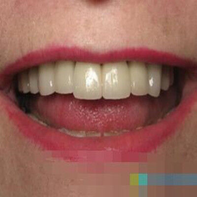 牙齿缺失对身体有危害吗？种植牙具备什么优势呢？