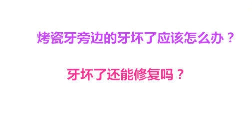 烤瓷牙旁边的牙坏了应该怎么办？牙坏了还能修复吗？