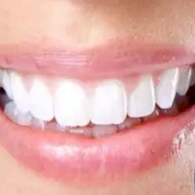还在让牙齿“咬牙”过冬？快get牙齿“保暖”秘籍