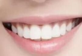 种牙正当时！为什么说春季是种牙的黄金期？