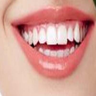 了解种牙等待时间差异，助你更快恢复笑容