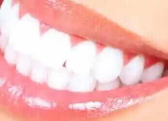 2025牙齿矫正新风向：从“整齐”到“健康”，功能与美学的双重革命