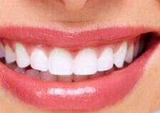 牙齿矫正消费分级：一线城市隐形矫正占比超40%，低线城市需求年增50%