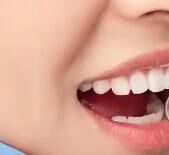 “颜值经济”渗透口腔：牙齿美白、贴面修复为何成社交刚需？