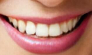 消费决策新路径：社交媒体如何影响种植牙的品牌选择与机构信任