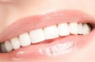 集采落地后，种植牙市场“量价齐升”还是“增量减利”？