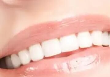 口腔材料革命：生物活性玻璃、纳米涂层如何改变治疗体验？