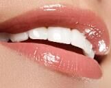 牙齿矫正：选隐形还是金属？