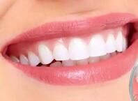 隐形正畸：数字化浪潮下的“颜值经济”新引擎