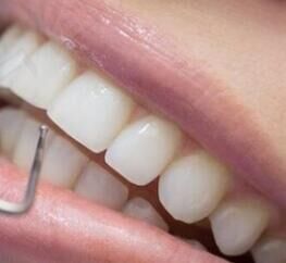 洗牙避坑指南：低价引流要警惕，正规报价才靠谱