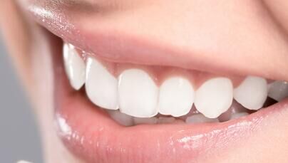 二三线城市正畸需求爆发！隐形矫治渗透率攀升，市场扩容空间显著