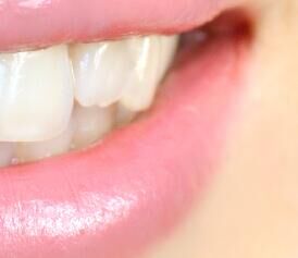 冷光牙齿美白原理全解析：480nm蓝光+过氧化氢，如何安全分解色素？