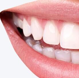 下沉市场爆发！冷光牙齿美白成为三四线城市消费新热点