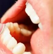 三线城市口腔消费报告：种植牙需求激增，性价比成关键决策因素