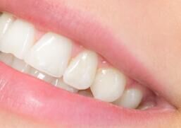 2030年种植牙市场预测：技术突破与消费趋势分析