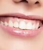 年轻人种牙新选择：隐形种植牙，笑起来不露&ldquo;金属痕迹&rdquo;