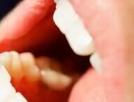 老年口腔消费升级：从&ldquo;治疗&rdquo;到&ldquo;预防+美容&rdquo;，功能性产品需求激增