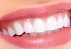 下沉市场崛起：县域老年口腔护理需求激增，便携式设备成新蓝海