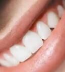 喷砂洗牙VS超声波洗牙：哪种更适合你的&ldquo;咖啡牙&rdquo;？