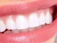 颜值经济驱动：牙齿美白、贴面等轻医美项目市场规模3年翻番