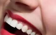 想尝试冷光牙齿美白，会伤害牙齿吗？真相在这里