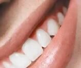 种植牙市场深度解析：2026规模将破1800亿，国产VS进口怎么选？