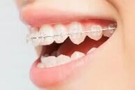 牙齿矫正价格悬殊？低价矫正的坑该如何避开？