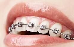 牙齿矫正区域市场分化：一线高端化VS下沉市场性价比之争