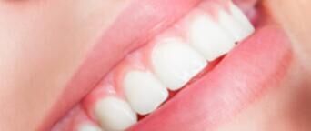 一线VS下沉，牙齿美容市场的消费差异与机会