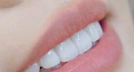 全瓷牙做完会有异物感吗？多久能适应？