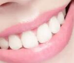 烤瓷牙与种植牙：哪种更适合你？