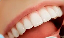 洗牙到底有多香？每年一次牙齿白净到发光