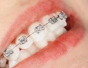 中老年人牙齿矫正：健康需求与可行性分析